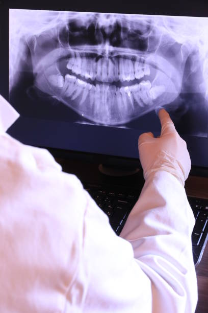 Best Emergency Dental Care for Abscessed Tooth in Du Quoin, IL