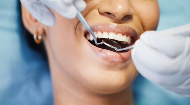 Best Emergency Dental Extractions in Du Quoin, IL