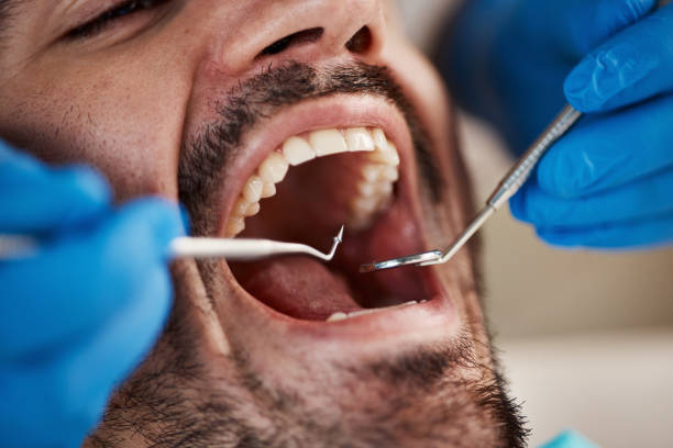 Best Emergency Dentist for Knocked-Out Tooth in Du Quoin, IL