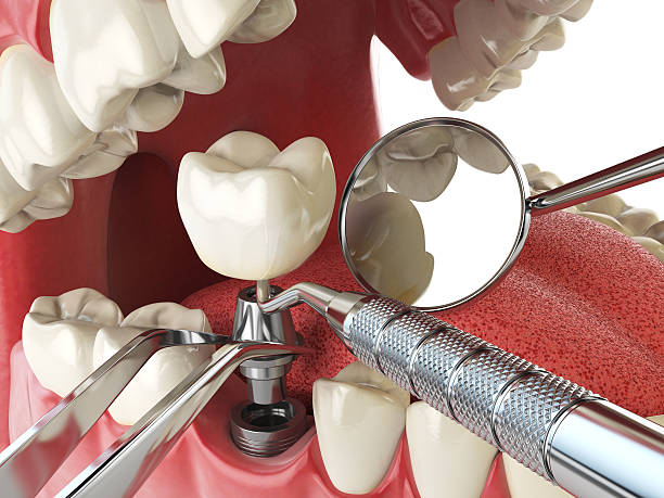Best Orthodontic Emergency Dentist in Du Quoin, IL